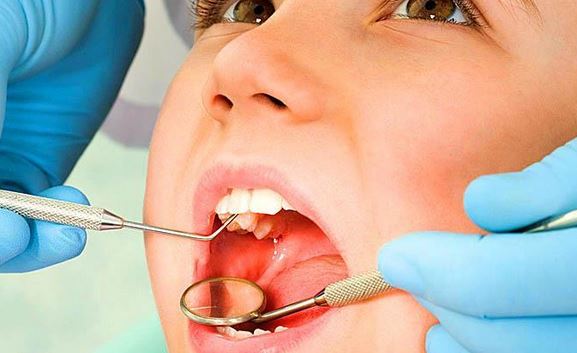 Usunięcie zęba pod narkozą na NFZ 